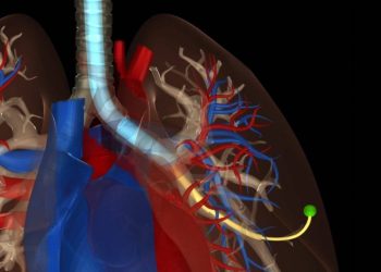 Minik robotlar akciğer zatürresini tamamen temizledi