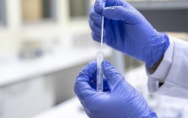 ABD ve bazı Avrupa ülkelerinde görülen Eris varyantına ilişkin Türkiye’den açıklama
