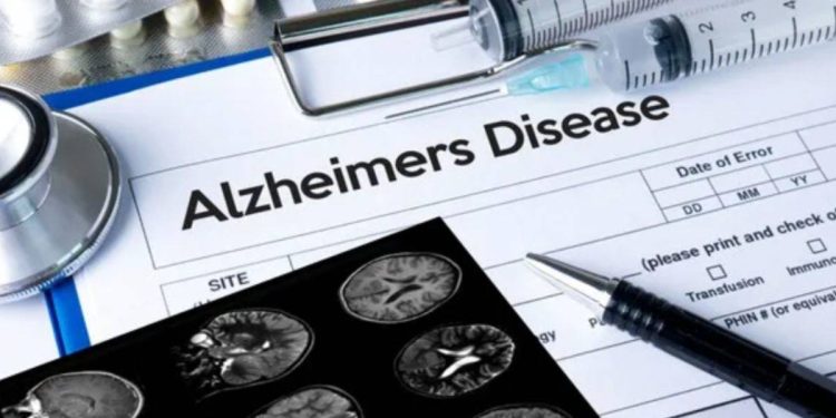 Alzheimer aşısında yeni gelişme
