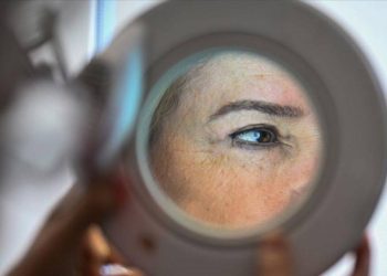 Cilt rengiyle ilişkili 135 yeni gen bulundu