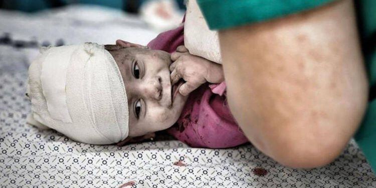 Gazze’den yaralanan bebeklerin hali yürek yaktı