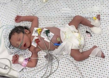 İsrail’in saldırısında öldürülen annenin karnındaki bebek kurtarıldı